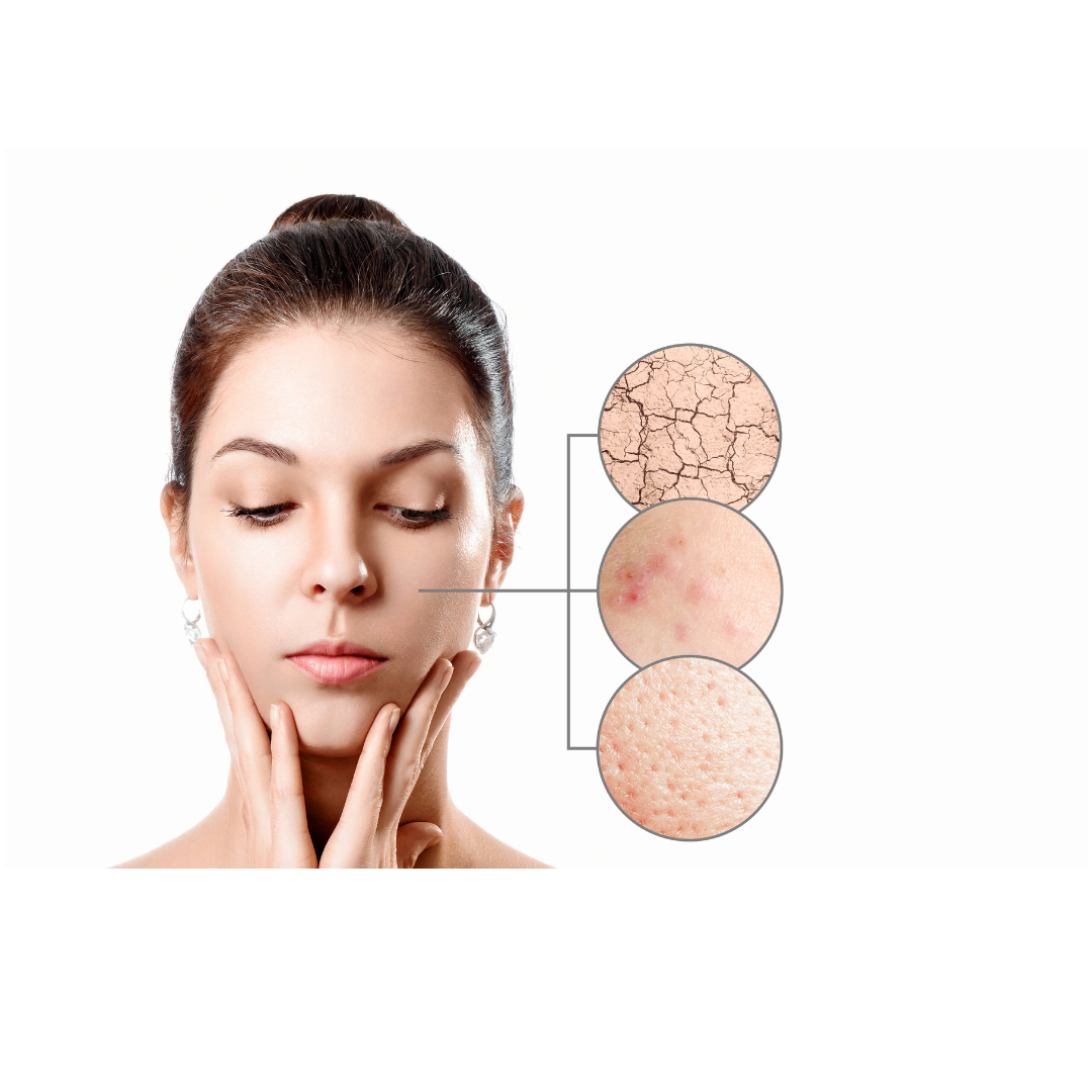 The Ins And Outs of Combination Skin